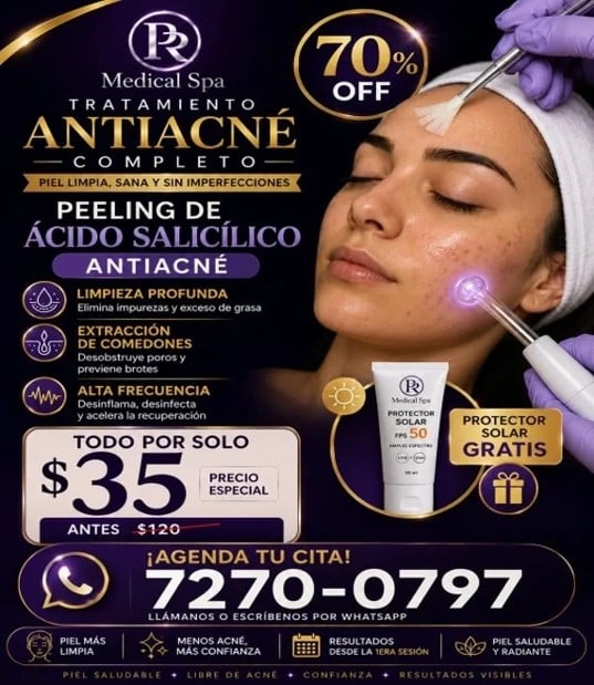 Peeling para acné: "Luce una piel más limpia, suave y sin imperfecciones".